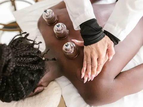 Practitioner placing clear cups along a woman's shoulder blade in a bright treatment room